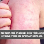 After the first case of measles in six years, NC health officials stress how important shots are