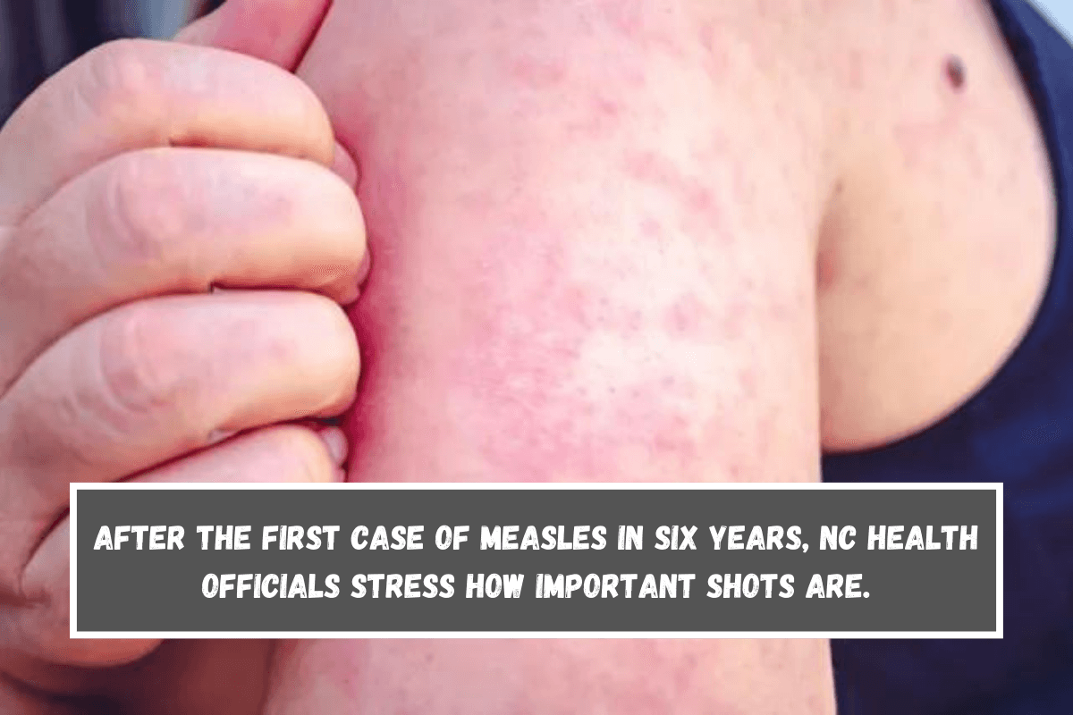 After the first case of measles in six years, NC health officials stress how important shots are