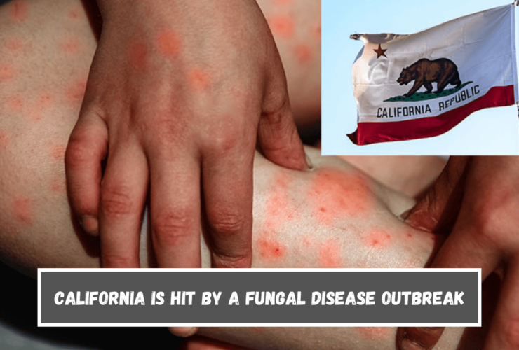 California is hit by a fungal disease outbreak