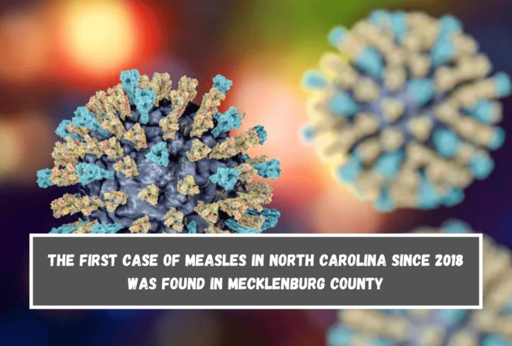 The first case of measles in North Carolina since 2018 was found in Mecklenburg County