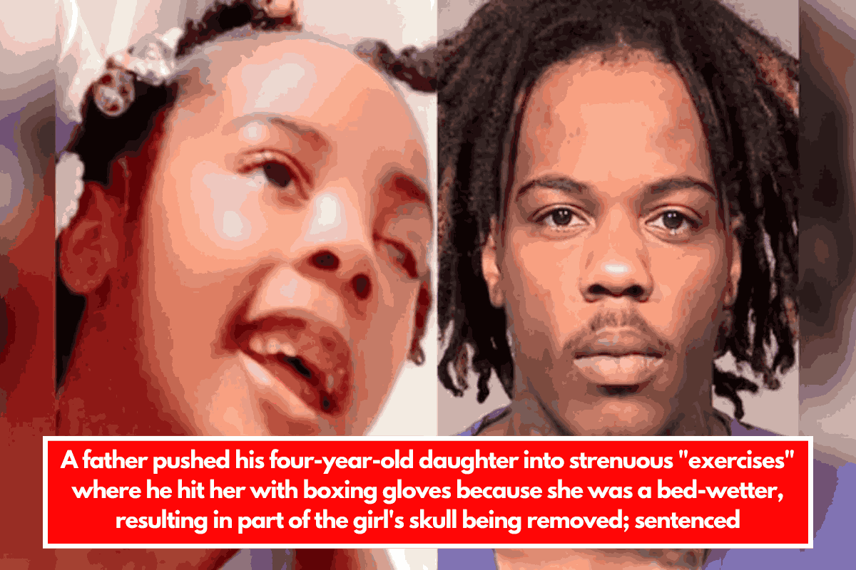 A father pushed his four-year-old daughter into strenuous "exercises" where he hit her with boxing gloves because she was a bed-wetter, resulting in part of the girl's skull being removed; sentenced