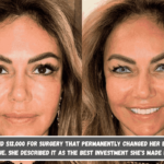 A woman paid $12,000 for surgery that permanently changed her eyes from brown to blue. She described it as the best investment she's made in herself